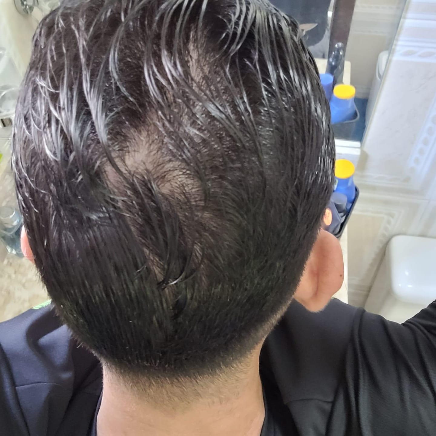 Customer photo review of Gummy® For Men - Black 90g