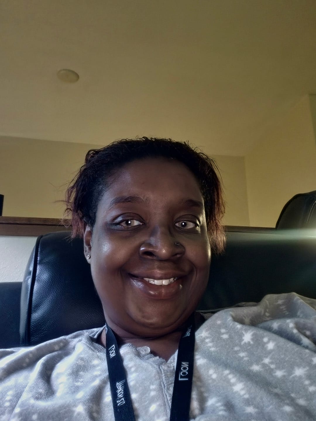 Customer photo review of Norko Gray Prescription Colored Contact Lenses