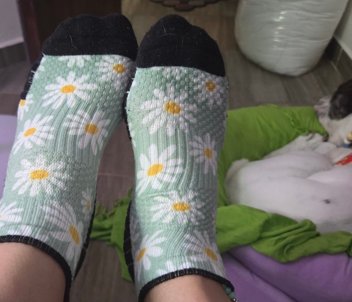 Customer photo review of Ankle Compression Buy 1 Get 2 Free Mystery Offer
