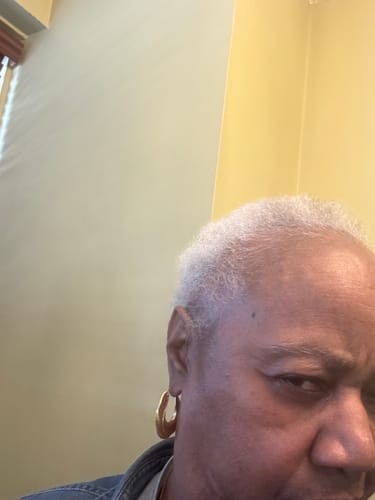 Close-up of a reviewer's hairline showing new growth in their short, grey hair.