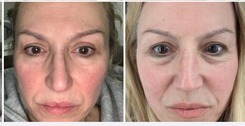Customer photo review of DERMIEYE PLUS