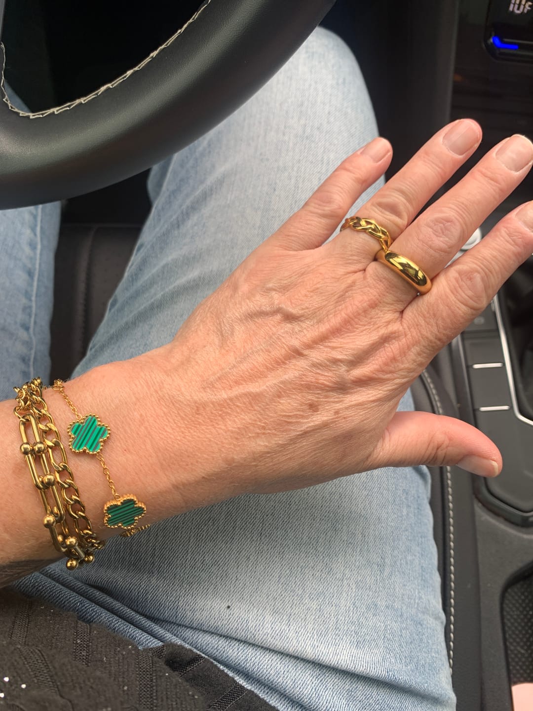 Customer photo review of Leilani Dome Ring (Bundle)