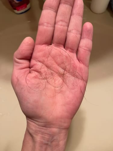 Ein Kunde hält eine kleine Menge ausgefallener Haare in der Hand, was auf einen geringeren Haarausfall nach der Anwendung der Haarseife hindeutet.