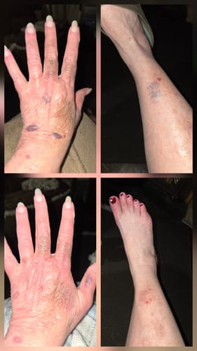 Customer photo review of Besque® Magic Body Oil XL - 200ml