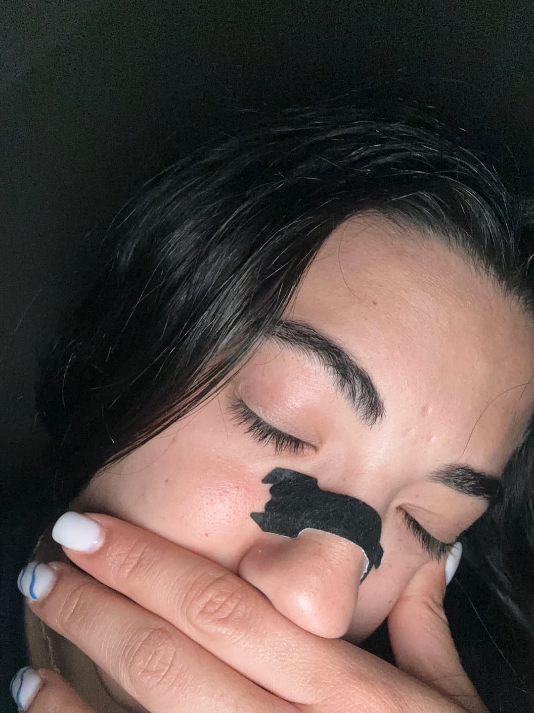 Customer photo review of Black Nasal Strips