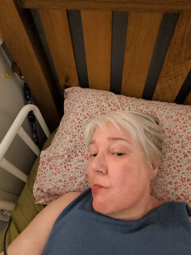 Customer photo review of Seb Natural Calming Serum
