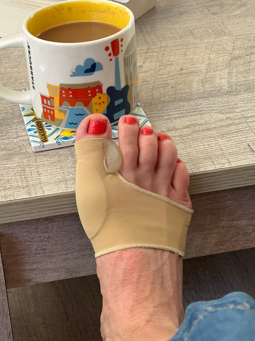 Customer photo review of Treatmedy™ Orthopedic Daytime Bunion Sleeve
