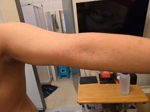 Customer photo review of Jolicare Cream