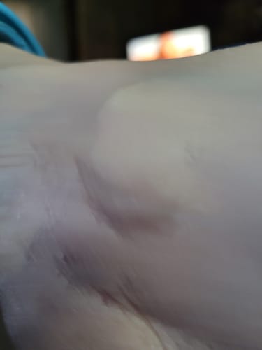 Customer photo review of TryTallow™ Grass-Fed Tallow Balm (4oz)