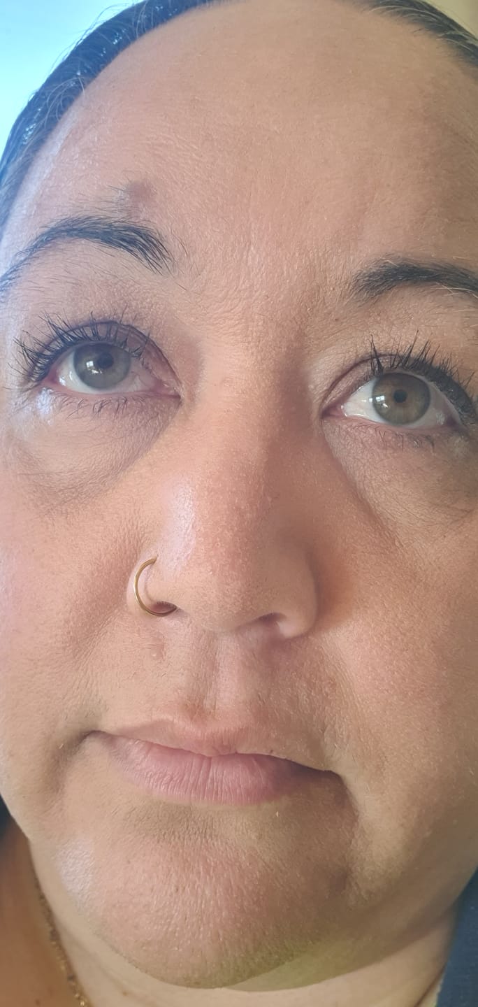 Customer photo review of Enhance® - Eyelash Growth Serum
