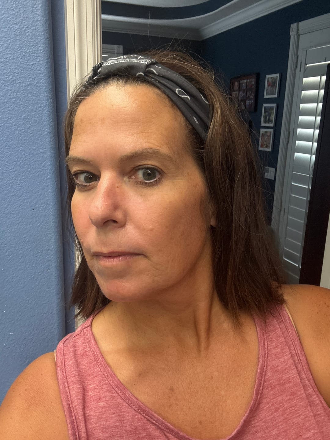 Customer photo review of The Complete System for Mature Women’s Skin