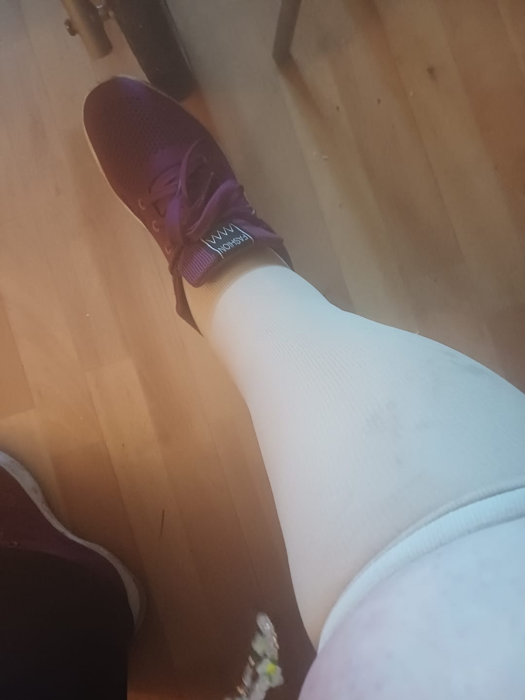 Customer photo review of EverSock™ Wide Compression Socks For Pain Relief