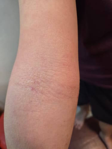 Customer photo review of Jolicare Cream