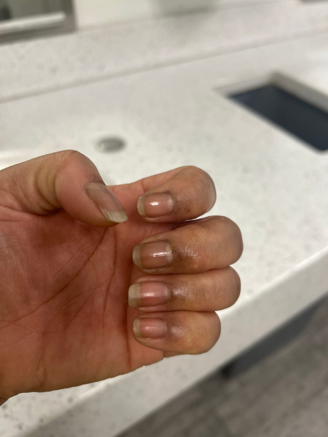Customer photo review of Gro & Glow Liquid Vitamins - 2 Month Supply!