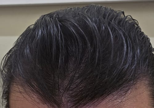 Gros plan sur les cheveux d'un client après application du camouflage capillaire.