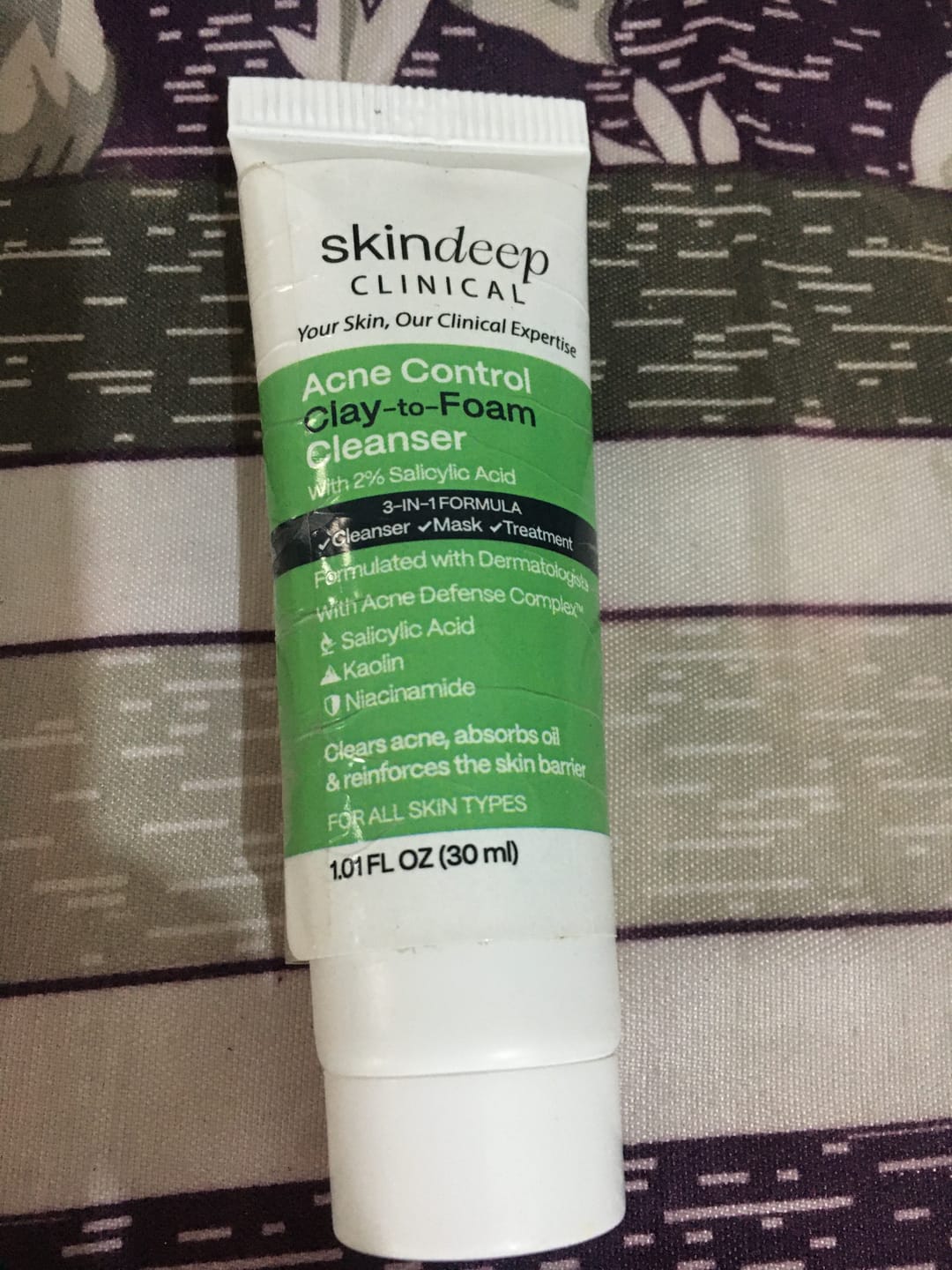 Customer photo review of Acne Control Clay-to-Foam Cleanser