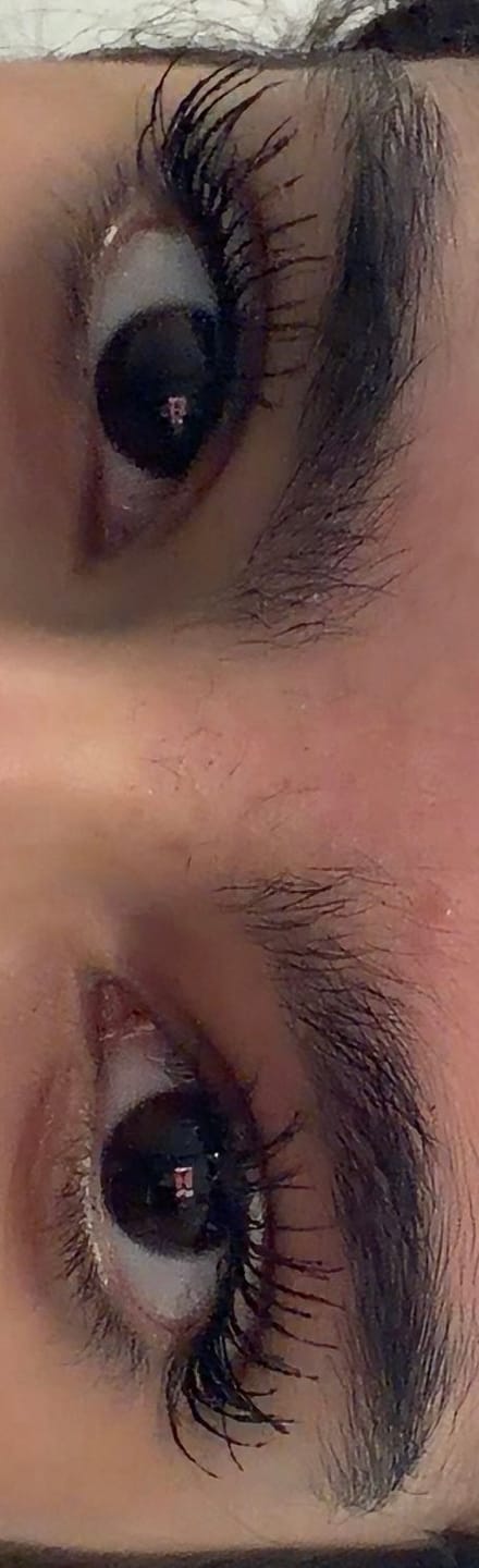 Customer photo review of Eyelash Growth Serum