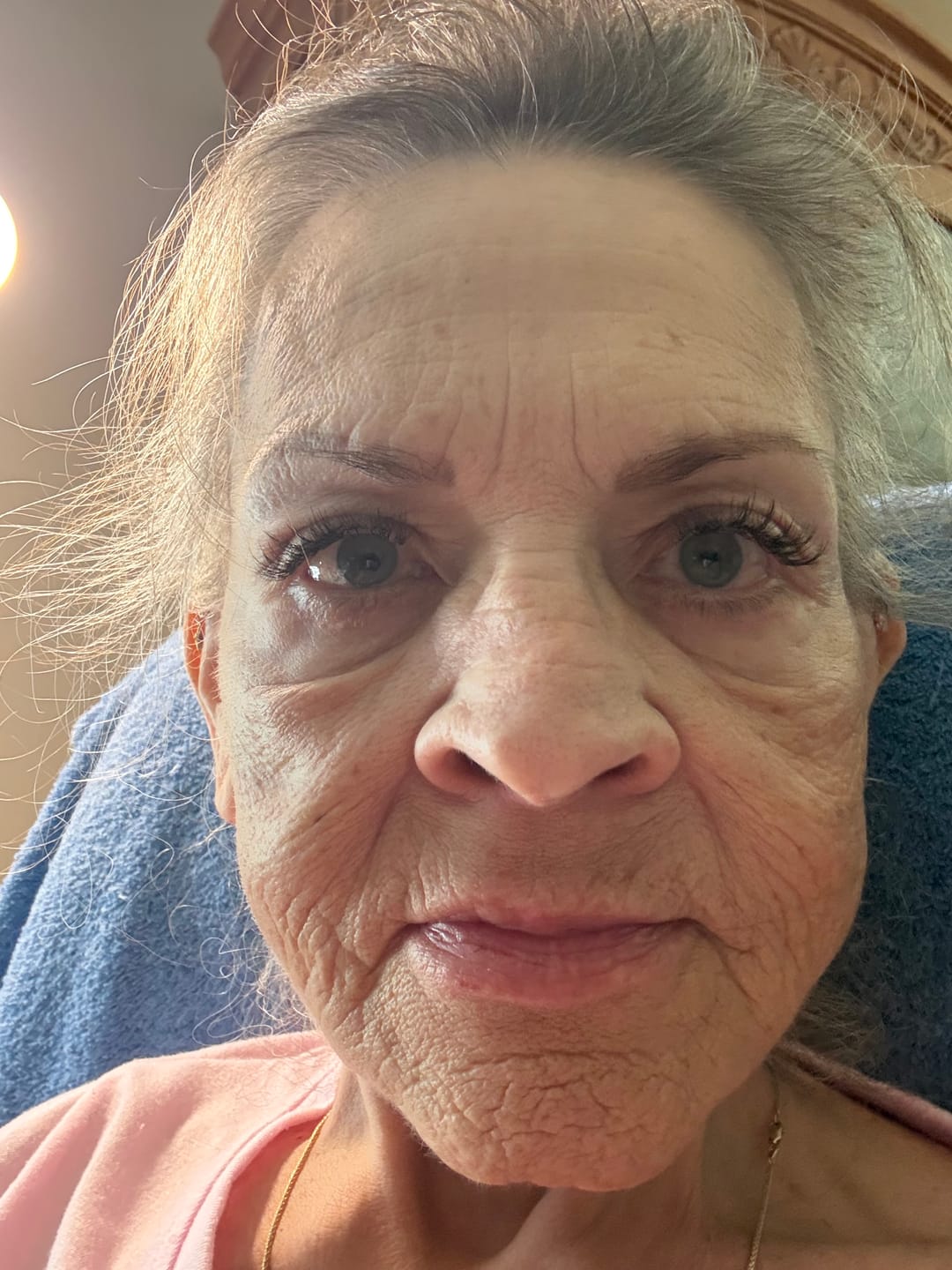 Customer photo review of Koriderm™ Time Reverse Cream (All-In-One)