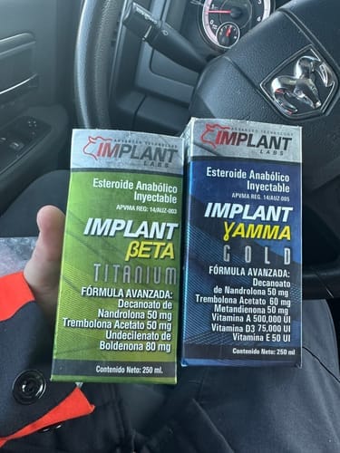 Customer photo review of Implant Beta Titanium