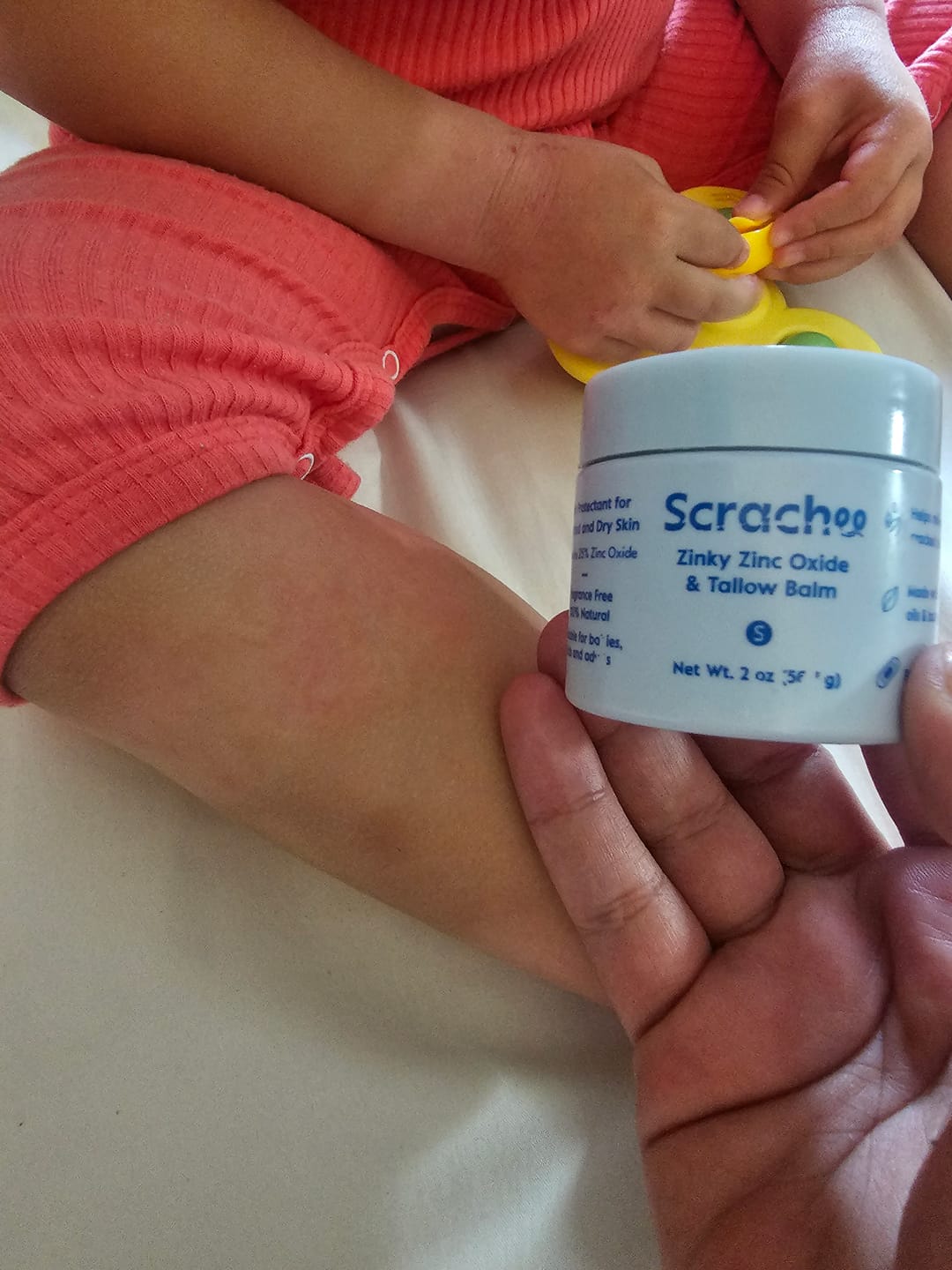 Customer photo review of Zinky Zinc Oxide & Tallow Balm