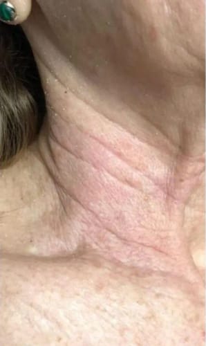 Customer photo review of Herth & Bloom 7-in-1 LED Facial Sculptor
