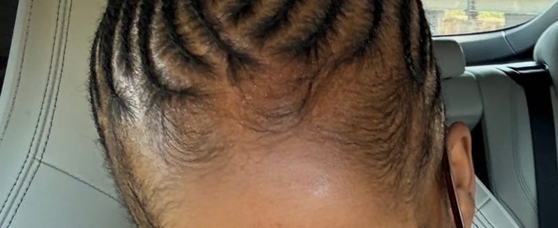 Customer photo review of 100% Unrefined Batana Oil 4 oz