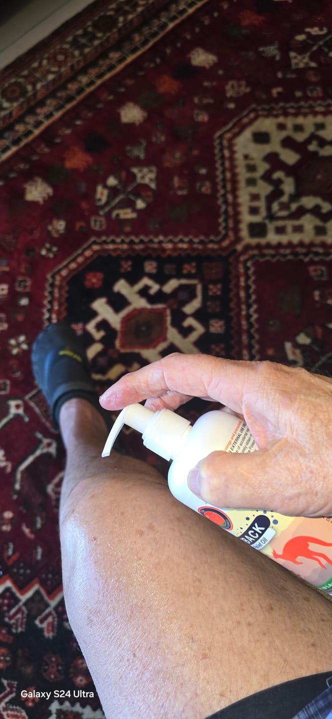 Customer photo review of Outback Pain Relief™ Oil 50ML Roll-On