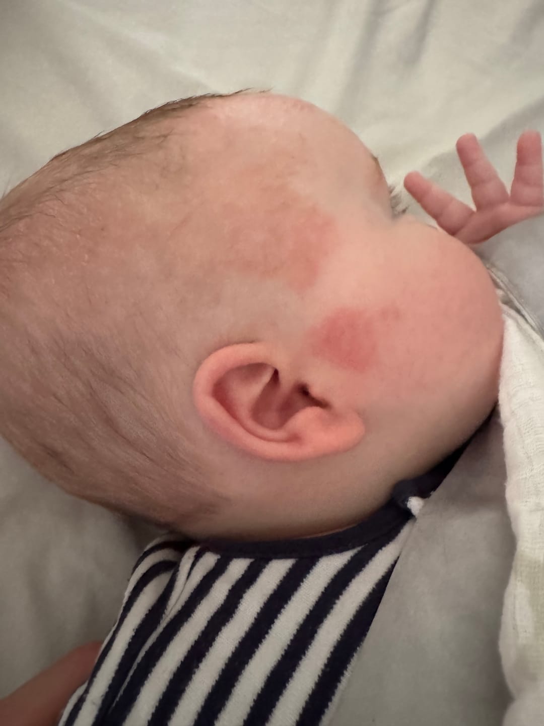 Customer photo review of Bioskin Junior Value Bundle