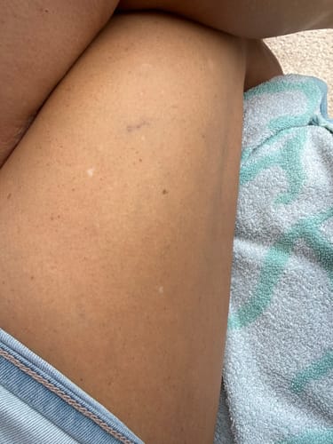Customer photo review of Besque® Magic Body Oil - 100ml