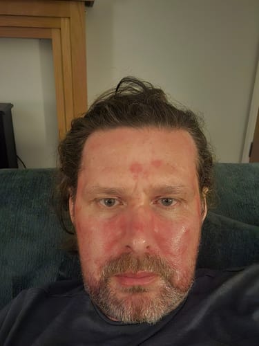 Customer photo review of Seb Natural Calming Serum