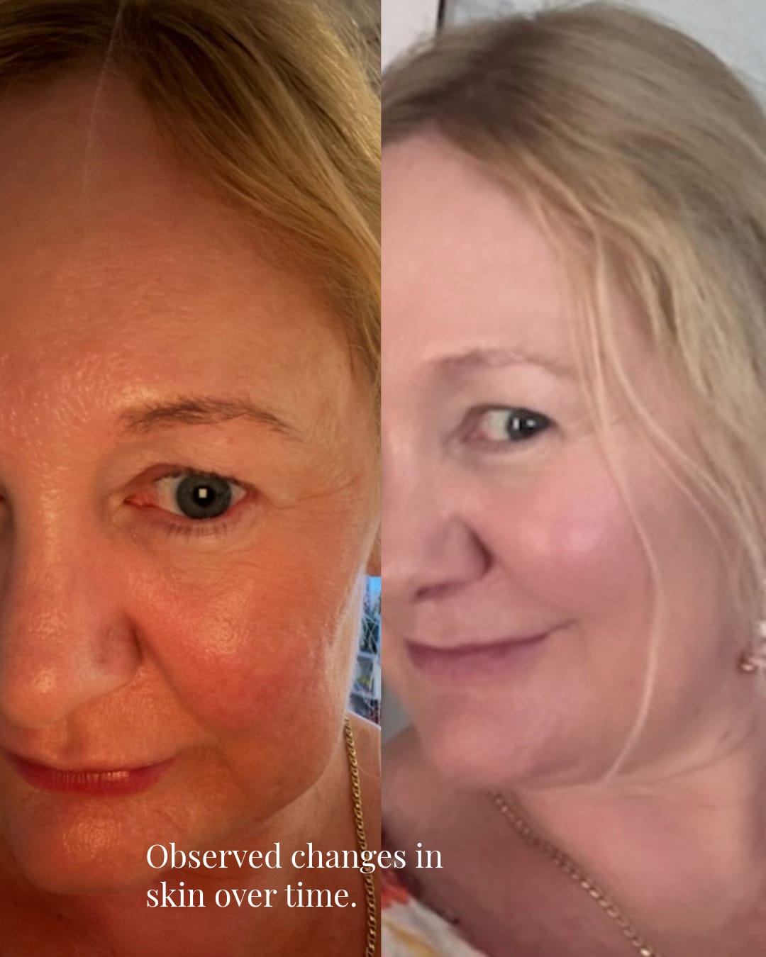 Customer photo review of Kakadu + Australian Rose Duo | Balance, Soothe + Feed
