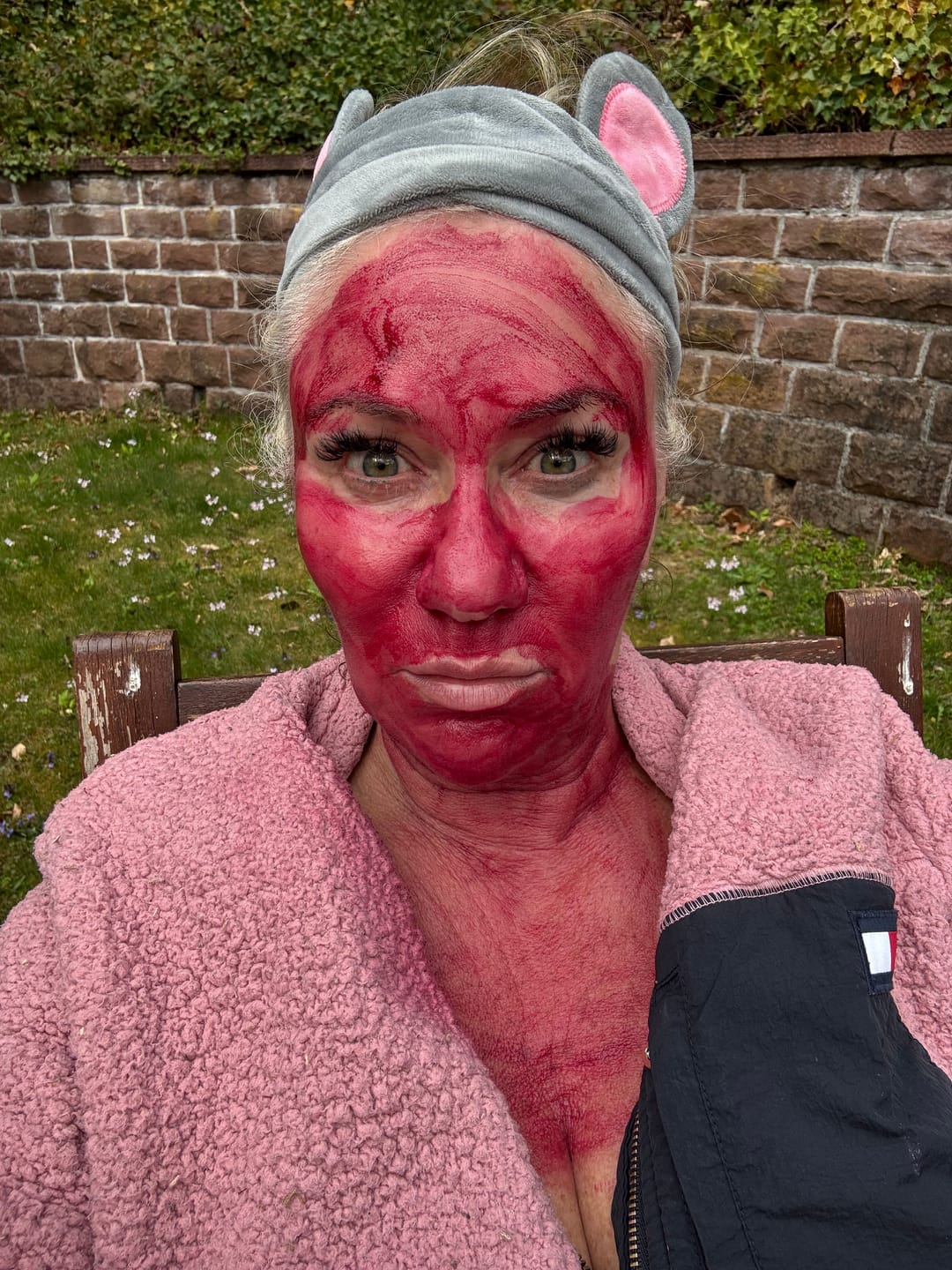 Customer photo review of VAMPIRE PEEL® - Fruchtsäurepeeling