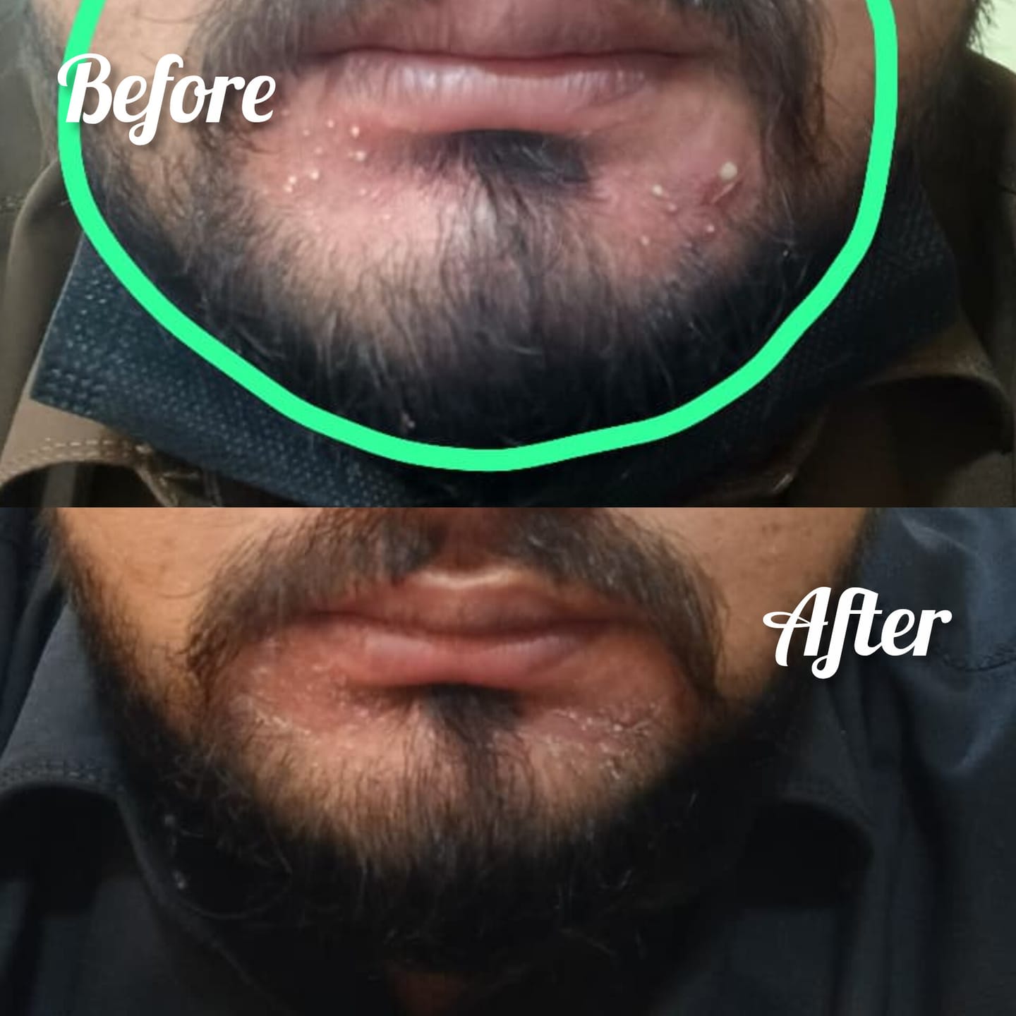 Customer photo review of MandelAC Serum
