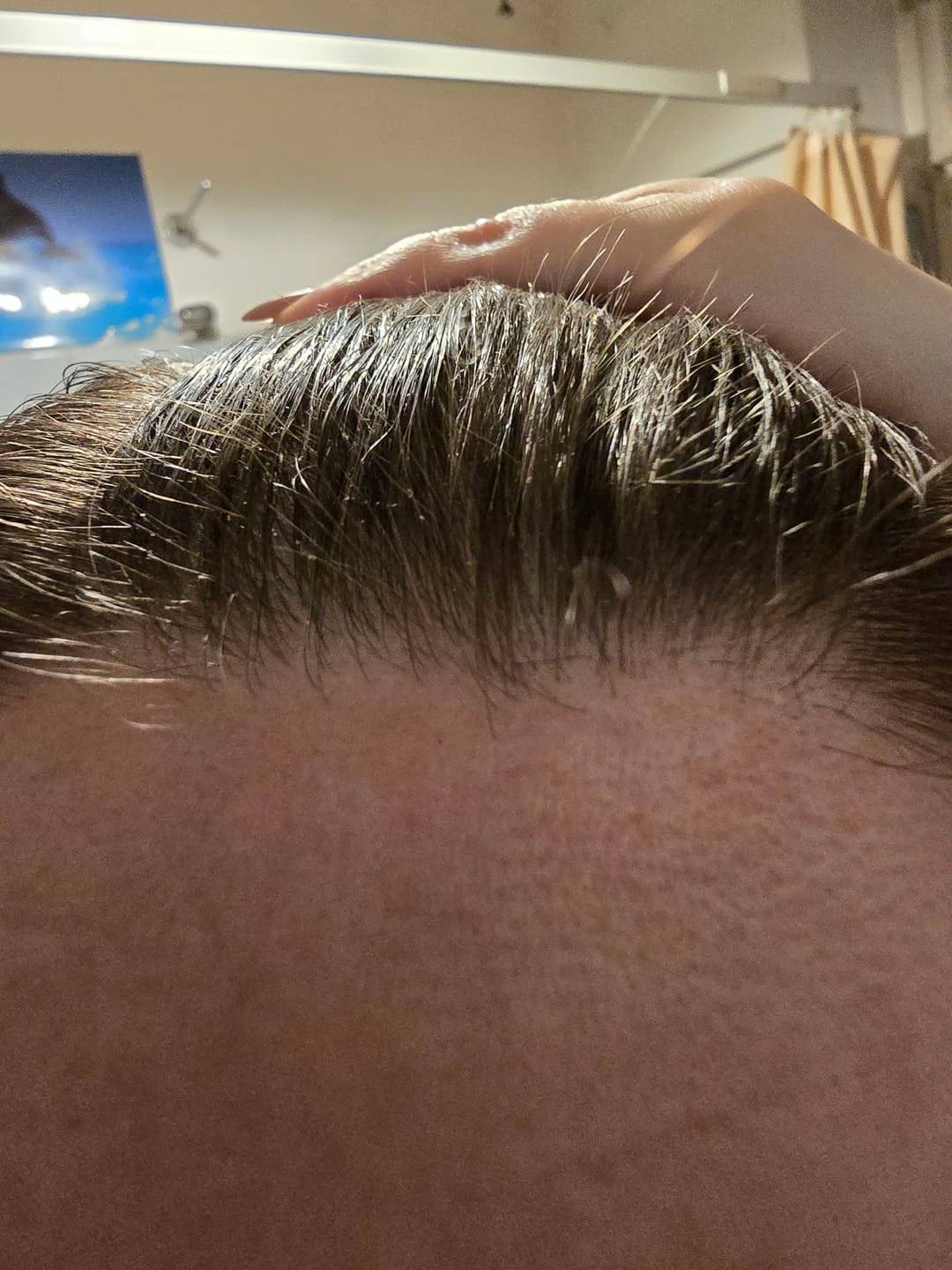 Customer photo review of Hair Loss Prevention Kit