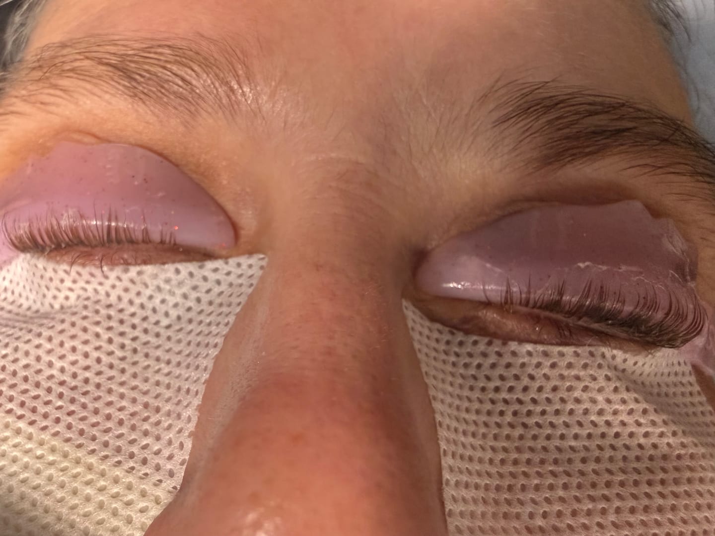 Customer photo review of TEARDROP SHAPE SILICONE LASH LIFT RODS