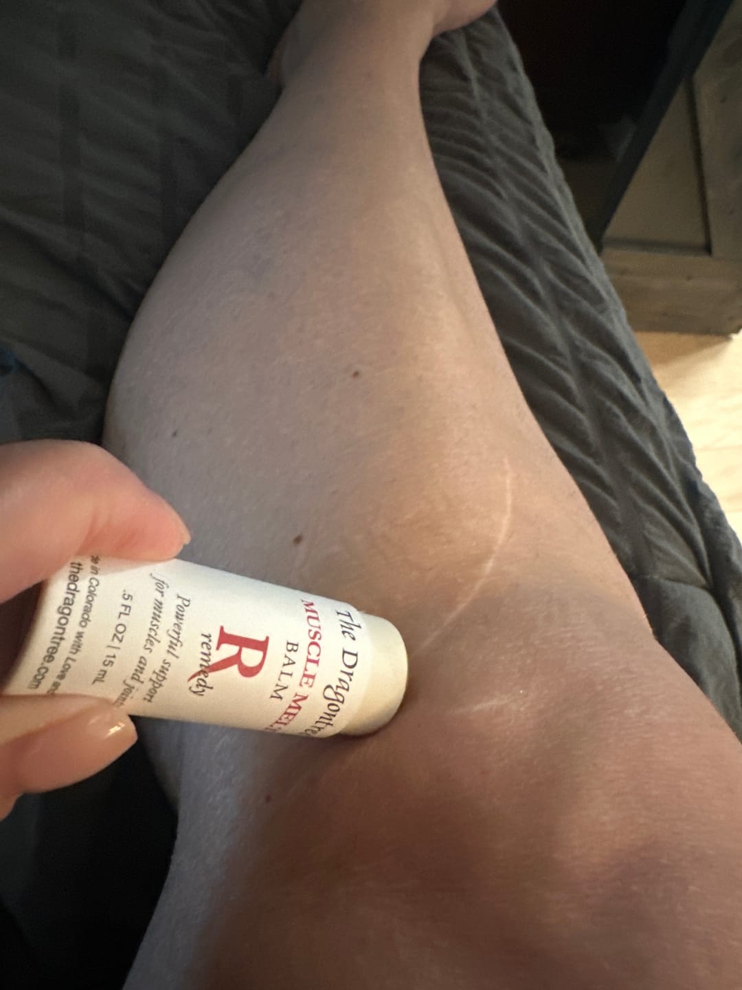 Customer photo review of Muscle Melt Balm