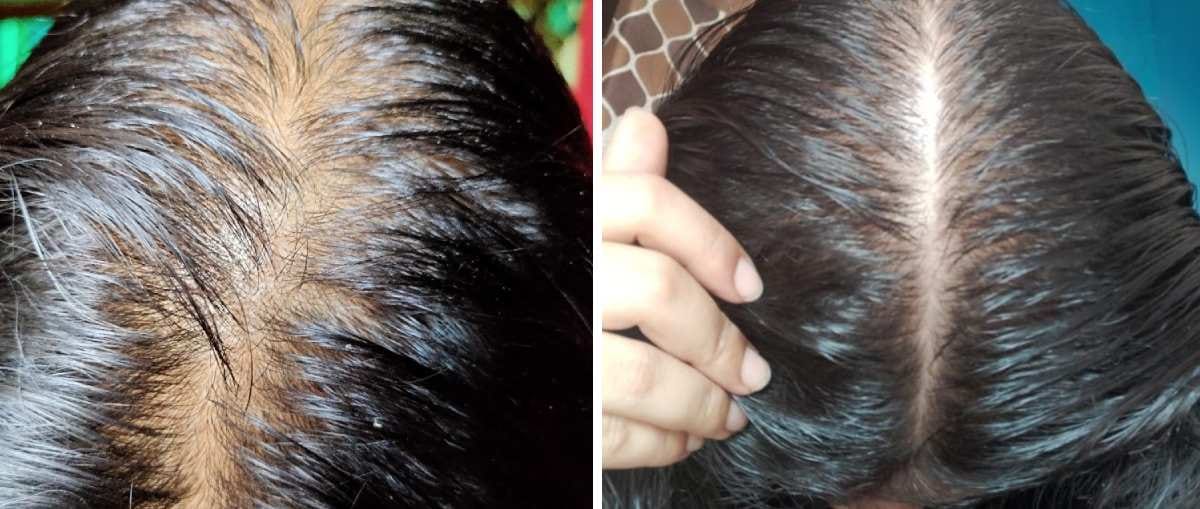 Customer photo review of Anagrow Shampoo