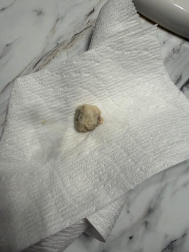 Customer photo review of V-PEARLS YONI DETOX  "Keep It Pure" - Yoni Detox