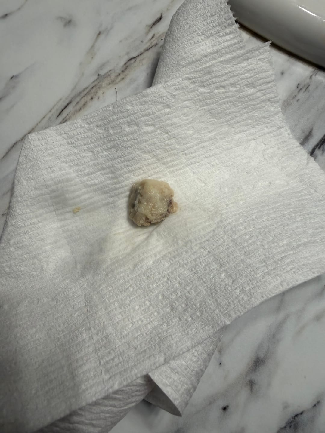 Customer photo review of V-PEARLS YONI DETOX  "Keep It Pure" - Yoni Detox