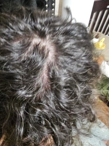 A close-up of a customer's scalp showing hair thinning before using the rosemary and keratin shampoo.