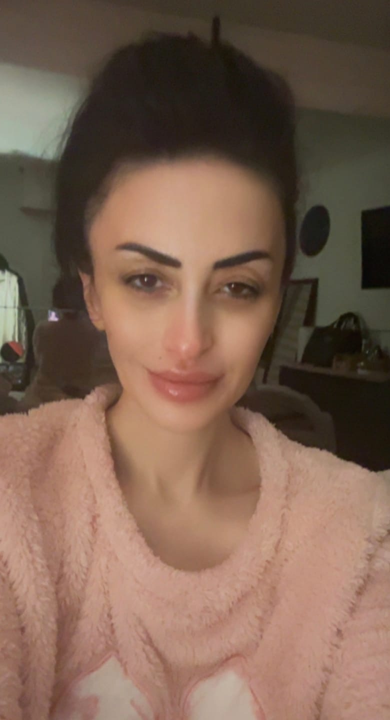 Customer photo review of Avokado Bomb Eye Cream