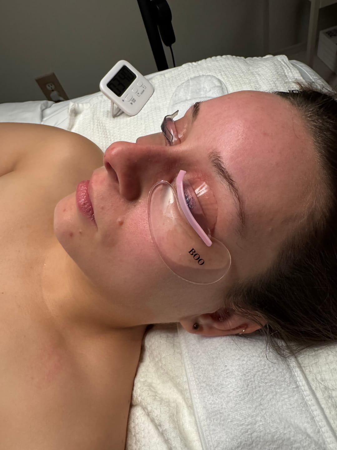 Customer photo review of Hypoallergenic Reusable Eye Pads