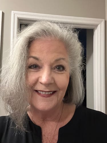 A smiling reviewer shows their smooth facial skin after using the Seranova Micro Infusion System.
