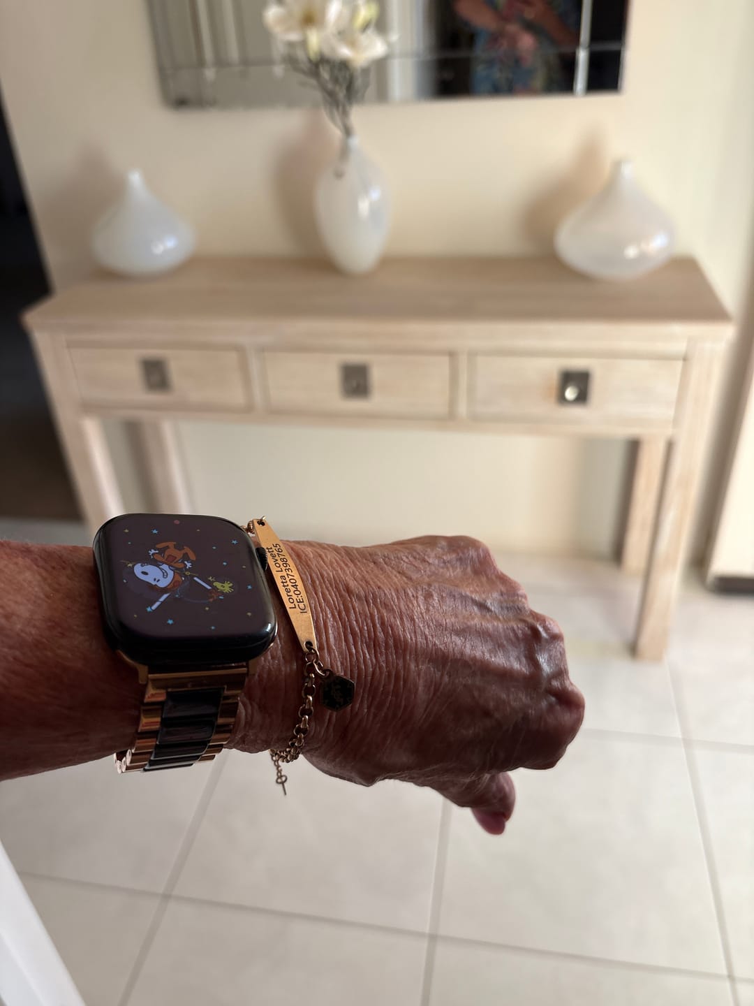Customer photo review of Rose Gold Colour Medical Alert Bracelet with Medical Charm