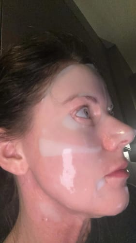 Customer photo review of LUMORA PDRN Renewal Infusion Mask 34ml x 4 sheets