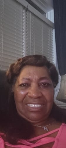 Customer photo review of Transform Wrinkles, Fine Lines, And Tired Creases Naturally