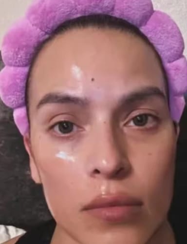 Customer photo review of LUMORA PDRN Renewal Infusion Mask 34ml x 4 sheets