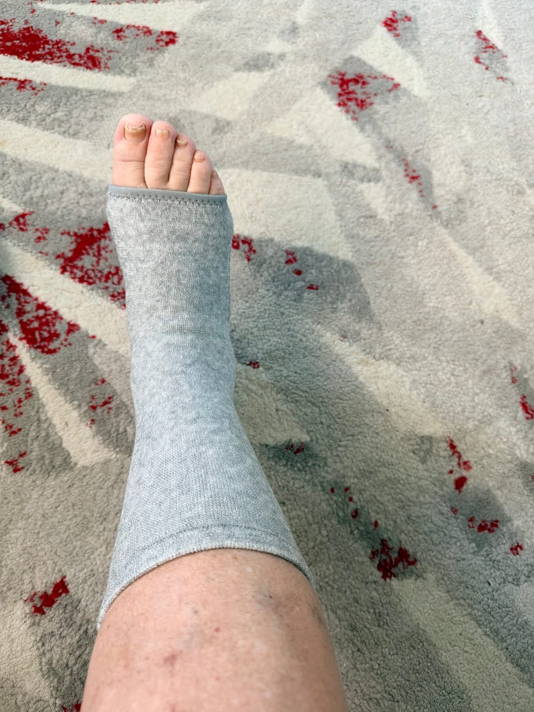 Customer photo review of Premium Anti-Fatigue Bamboo Footsleeves