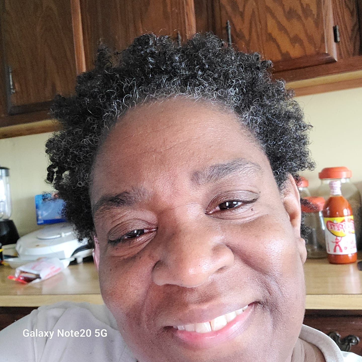 Customer photo review of Healthy Hair Starter Kit- Limited Edition