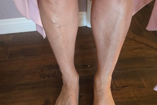 Customer photo review of Corrector Corporal